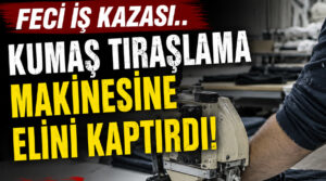 Feci kaza.. Kumaş Tıraşlama Makinesine Elini Kaptıran İşçi Hastanelik Oldu!